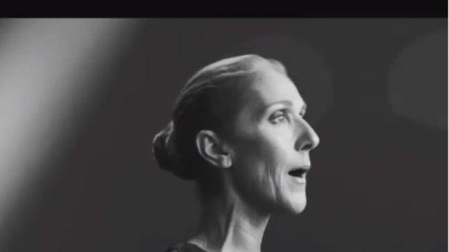 Tak Bisa Kendalikan Otot, Kenali Stiff Person Syndrome yang tersebut Diderita Celine Dion